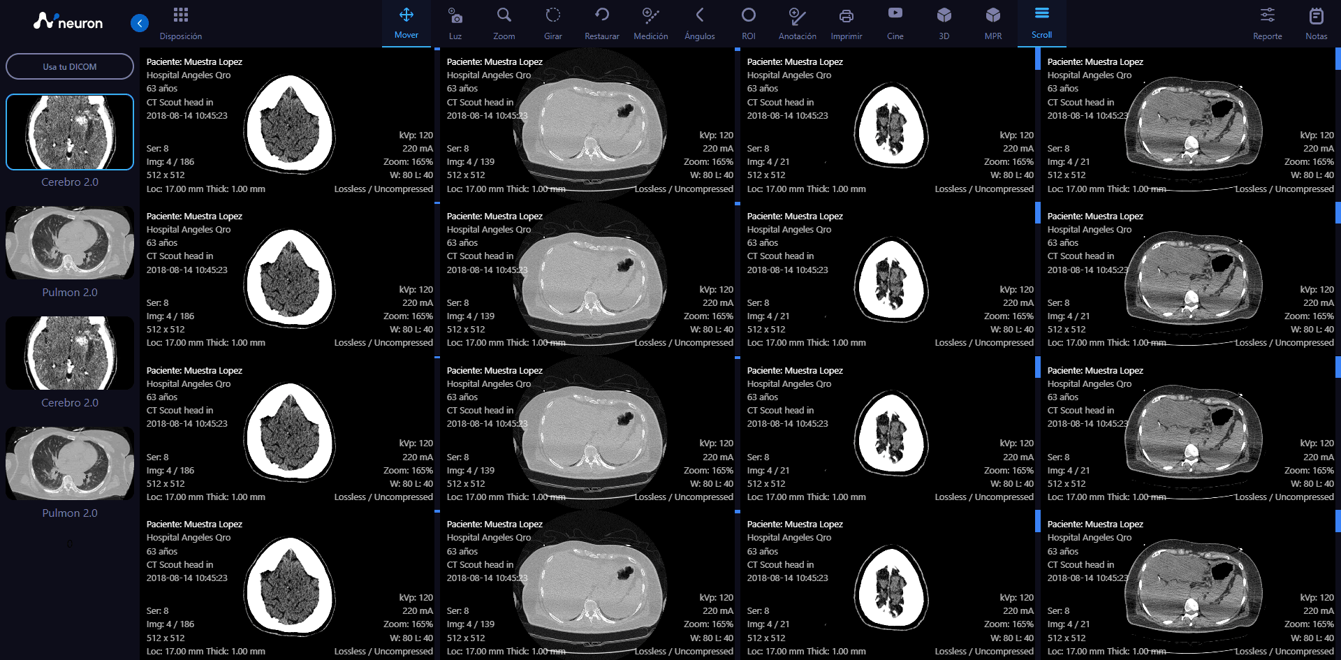 NEURON PACS